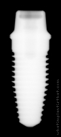 Radiograph of NobelDirect Posterior