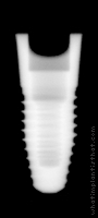 Radiograph of NobelPerfect (View A)