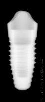 Radiograph of NobelPerfect (View B)