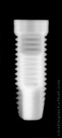 Radiograph of NobelReplace Straight Groovy RP