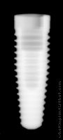 Radiograph of NobelReplace Tapered Groovy RP