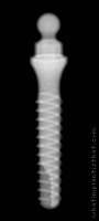 Radiograph of OBI