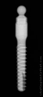 Radiograph of OBI