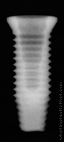 Radiograph of OSSEOTITE Certain PREVAIL