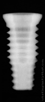 Radiograph of OSSEOTITE Certain PREVAIL