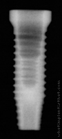 Radiograph of OSSEOTITE Certain PREVAIL