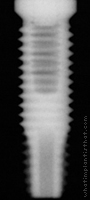 Radiograph of OSSEOTITE Parallel Walled