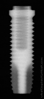 Radiograph of OSSEOTITE Parallel Walled