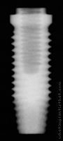 Radiograph of OSSEOTITE Parallel Walled