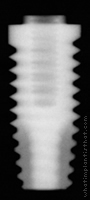 Radiograph of OSSEOTITE Parallel Walled