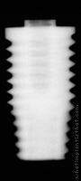 Radiograph of OSSEOTITE Parallel Walled