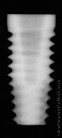 Radiograph of OSSEOTITE Parallel Walled Certain