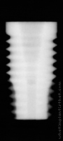 Radiograph of OSSEOTITE Parallel Walled Certain