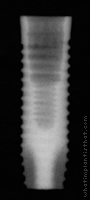 Radiograph of OSSEOTITE Parallel Walled Certain