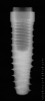 Radiograph of OSSEOTITE Tapered