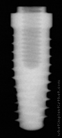 Radiograph of OSSEOTITE Tapered