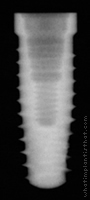 Radiograph of OSSEOTITE Tapered Certain
