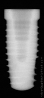 Radiograph of OSSEOTITE Tapered Certain