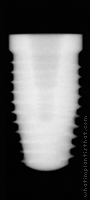 Radiograph of OSSEOTITE Tapered Certain
