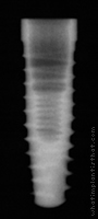 Radiograph of OSSEOTITE Tapered Certain
