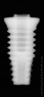 Radiograph of OSSEOTITE XP