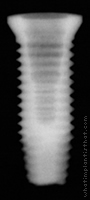Radiograph of OSSEOTITE XP Certain