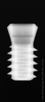 Radiograph of Octagon (Regular Short)