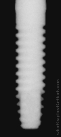 Radiograph of One-piece RBT