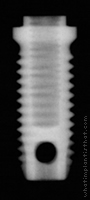 Radiograph of Original Branemark