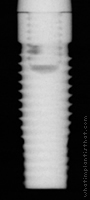 Radiograph of Steri-Oss Flat Top