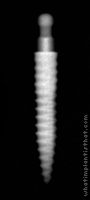 Radiograph of Lew O-Ball MDI (non-collared)