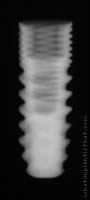 Radiograph of PUR (NP)