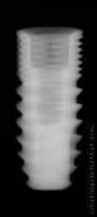 Radiograph of PUR (NP)