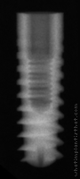 Radiograph of Pitt-Easy - Puretex