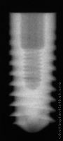 Radiograph of Pitt-Easy - Puretex