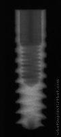 Radiograph of Pitt-Easy - Puretex