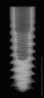 Radiograph of Pitt-Easy - TPS