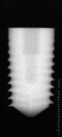 Radiograph of Pitt-Easy - TPS