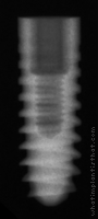 Radiograph of Pitt-Easy - TPS