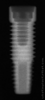 Radiograph of PrimaConnex Straight