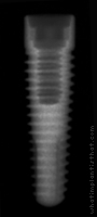 Radiograph of PrimaConnex Tapered