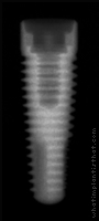 Radiograph of PrimaConnex Tapered