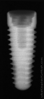 Radiograph of PrimaConnex Tapered