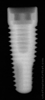 Radiograph of PrimaConnex Tapered