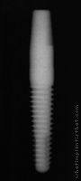Radiograph of PrimaSolo One Piece Tapered