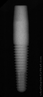 Radiograph of PrimaSolo One Piece Tapered