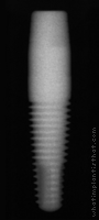 Radiograph of PrimaSolo One Piece Tapered