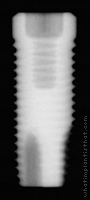 Radiograph of ProActive
