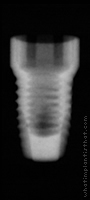 Radiograph of ProActive