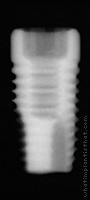 Radiograph of ProActive